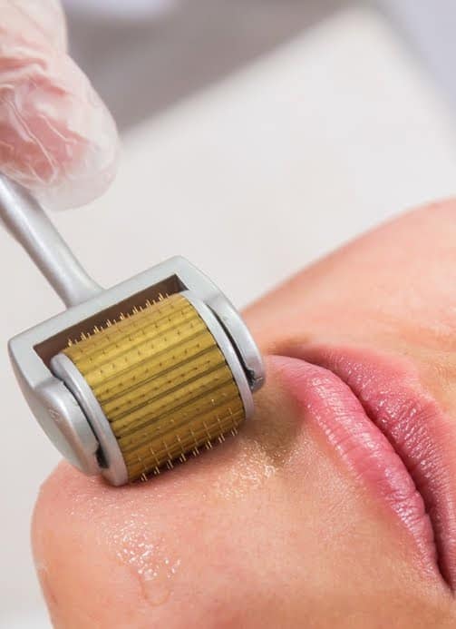 Collagen Induction Therapy