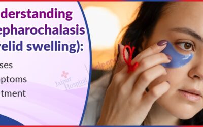 Understanding Blepharochalasis (Eyelid swelling): Causes, Symptoms, and Treatment