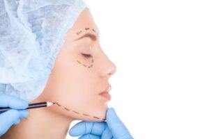 What are the types of Dimple Creation Surgery?