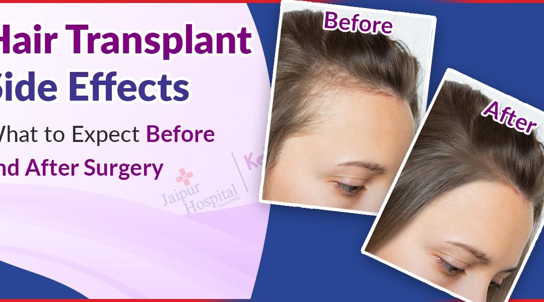 Hair Transplant Side Effects: What to Expect Before and After Surgery