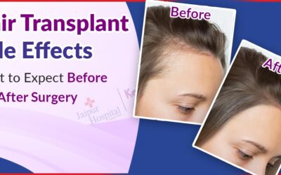 Hair Transplant Side Effects: What to Expect Before and After Surgery