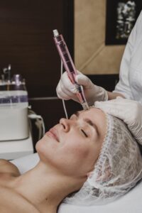 What Is Facial Mesotherapy?