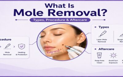 What Is Mole Removal? Types, Procedure, and Aftercare