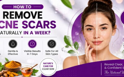 How to Remove Acne Scars Naturally in a Week?