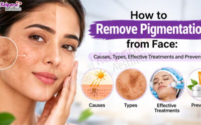 How to Remove Pigmentation from Face: Causes, Types, Effective Treatments and Prevention